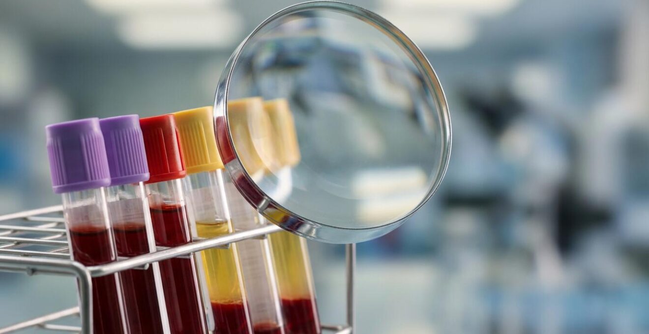 Tubes d'analyses sanguines sous une loupe avec éclairage de laboratoire scientifique