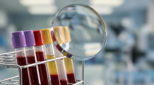 Tubes d'analyses sanguines sous une loupe avec éclairage de laboratoire scientifique